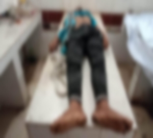 কারাগারে গলায় লুঙ্গি পেঁচিয়ে হাজতির মৃত্যু